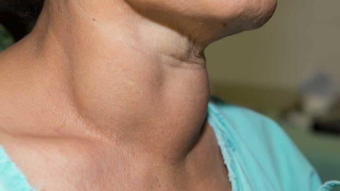 Thyroid health and metabolism support